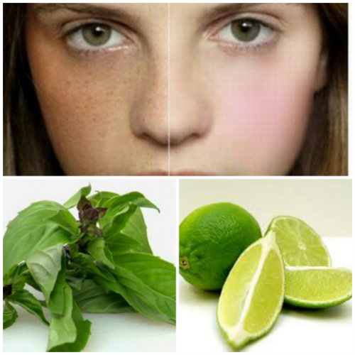 Những Cách Trị Nám Tại Nhà Đơn Giản