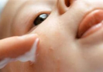 Bệnh Viêm Da Cơ Địa & Cách Chữa