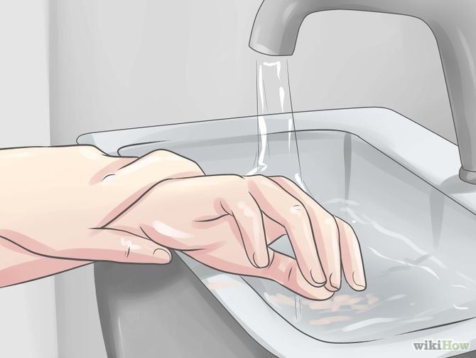 12 Cách Trị Sẹo Lồi Lâu Năm Tại Nhà Hiệu Quả