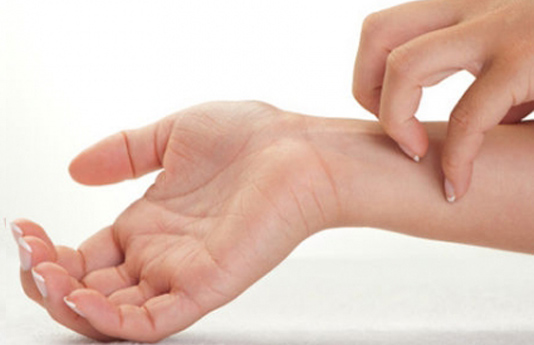 Những Triệu Chứng Của Viêm Da Dị Ứng