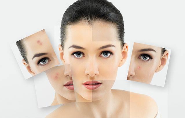 Làm Sao Để Hết Mụn Tận Gốc - Stamford Skin Centre