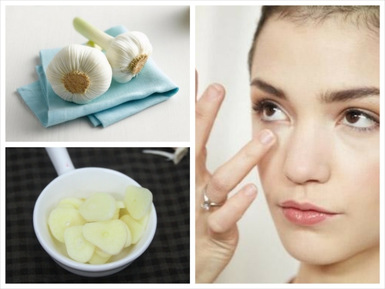 Phương Pháp Trị Sẹo Lồi Hiệu Quả Tại Nhà