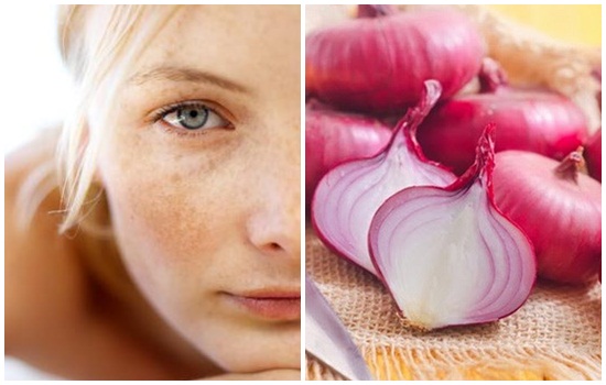 Những Cách Chữa Tàn Nhang Từ Thiên Nhiên