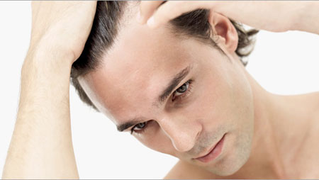 Cấy Tóc Là Gì? Giá Cấy Tóc Bao Nhiêu?