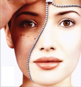 NÁM, TÀN NHANG, BỚT HORI & OTA