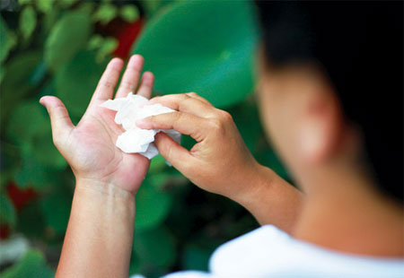 BỆNH TĂNG TIẾT MỒ HÔI