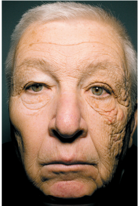 TÀI XẾ BỊ LÃO HOÁ MỘT BÊN MẶT VÌ TIA NẮNG