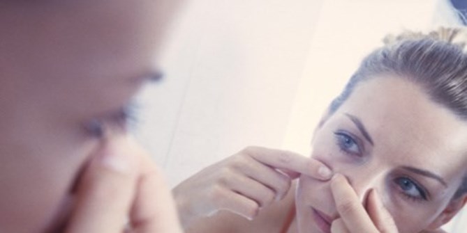 6 Nguyên Nhân Bất Ngờ Gây Sẹo Rỗ Ở Mặt