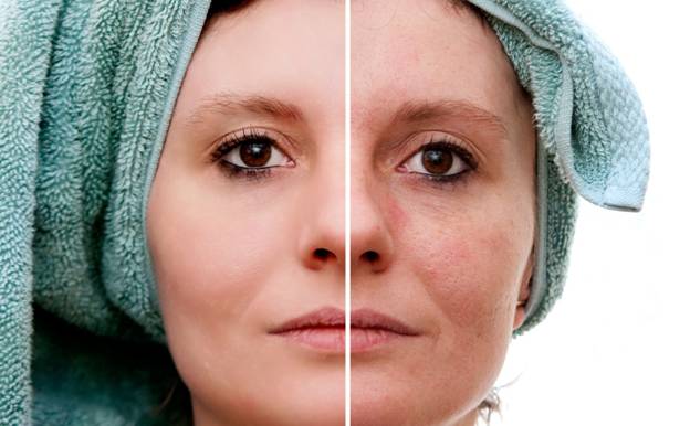 TRIỆT LÔNG VĨNH VIỄN, TRẺ HÓA LÀN DA BẰNG CÔNG NGHỆ CLARITY