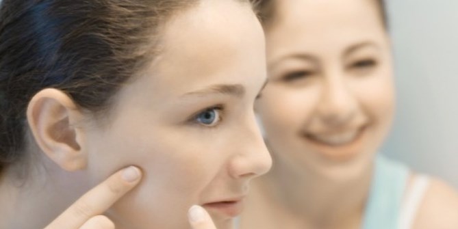 Nguyên Nhân Bất Ngờ Gây Sẹo Rỗ Ở Mặt