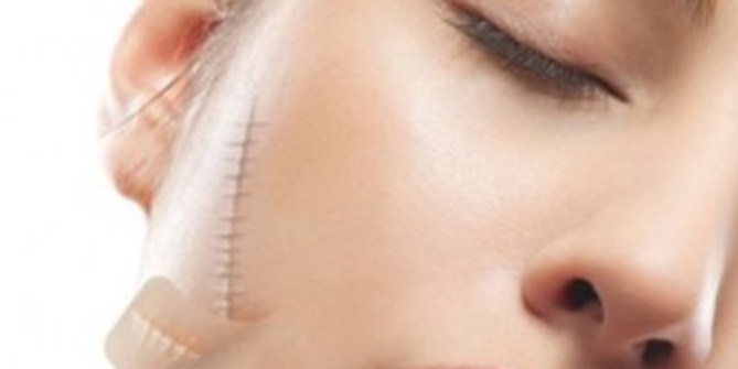 SẸO PHẪU THUẬT