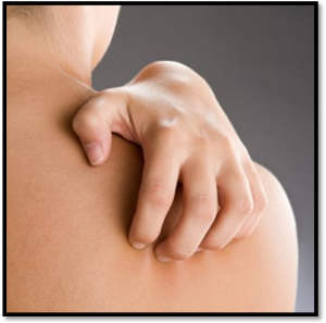 Ung Thư Da -  Triệu Chứng & Dấu Hiệu