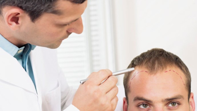 ĐIỀU TRỊ RỤNG TÓC, HÓI ĐẦU CHO ĐÀN ÔNG