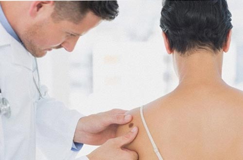 ĐIỀU TRỊ UNG THƯ DA TẬN GỐC