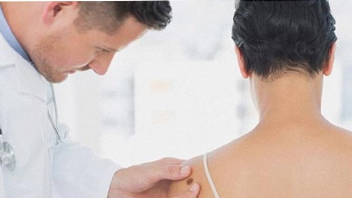 ĐIỀU TRỊ UNG THƯ DA TẬN GỐC