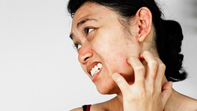 ĐIỀU TRỊ DỊ ỨNG DA