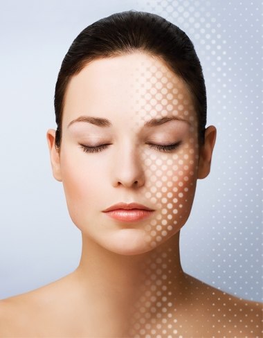 Bớt Hori Và Bớt Ota