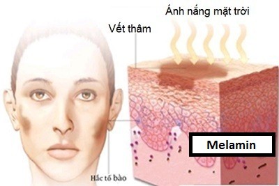 Điều Trị Thâm Mụn